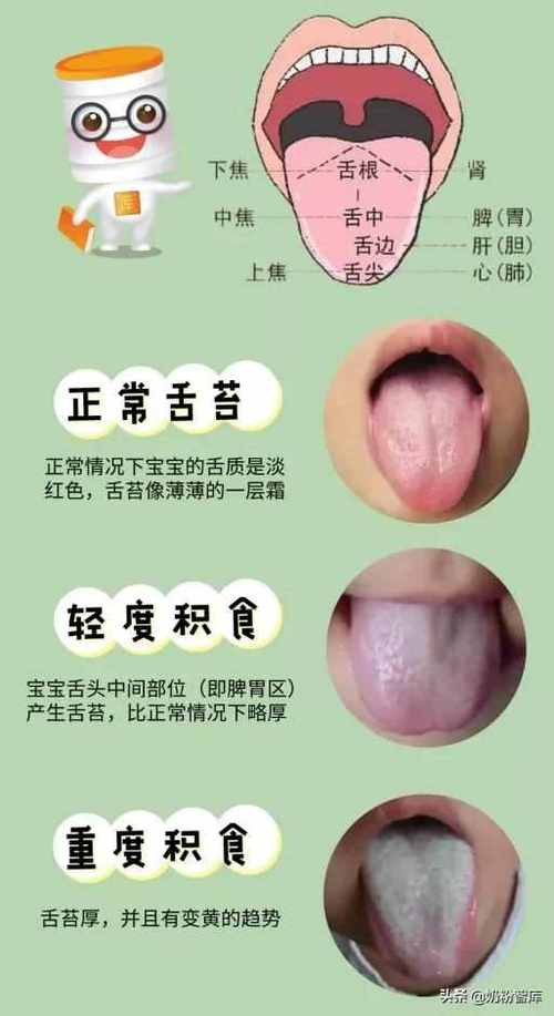 供卵代生的宝宝舌苔厚是什么原因